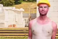 Ob im Beruf oder in der Freizeit - die Haut ist besonders in den Sommermonaten und vor allem im Freien starken Belastungen ausgesetzt. Viele Menschen gehen immer noch zu sorglos mit dem Hautkrebsrisiko um. Die BG ETEM räumt in der aktuellen Ausgabe ihrer Versichertenzeitung 